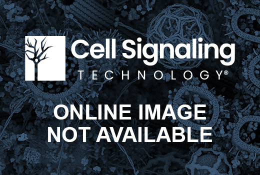 No image available